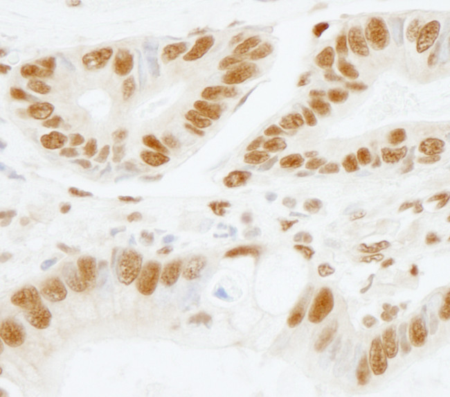 SF3b155/SAP155 Antibody in Immunohistochemistry (Paraffin) (IHC (P))
