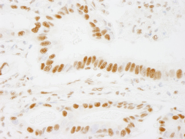 ACINUS/ACN1 Antibody in Immunohistochemistry (Paraffin) (IHC (P))