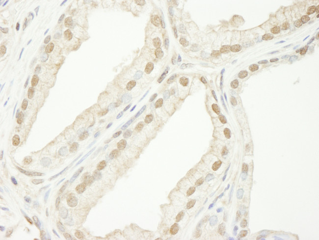 TRIM33/TIF1gamma Antibody in Immunohistochemistry (Paraffin) (IHC (P))