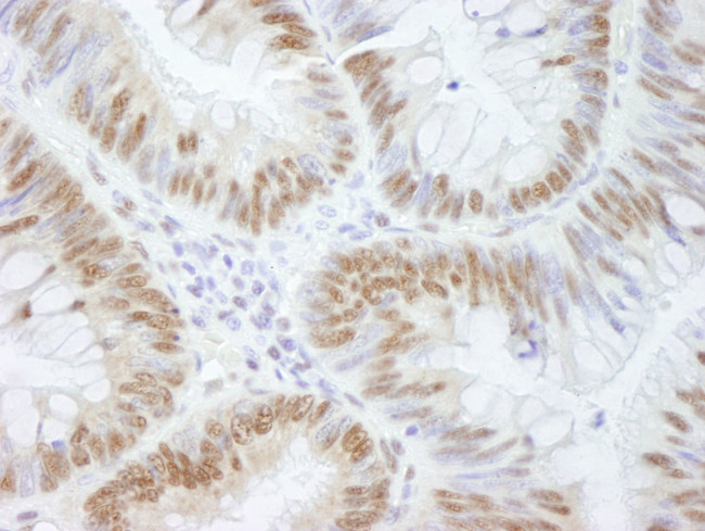AKAP8/AKAP95 Antibody in Immunohistochemistry (Paraffin) (IHC (P))