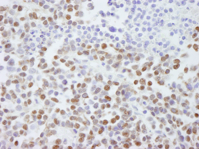 SAFB2 Antibody in Immunohistochemistry (Paraffin) (IHC (P))