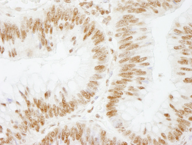 CSTF64 Antibody in Immunohistochemistry (Paraffin) (IHC (P))
