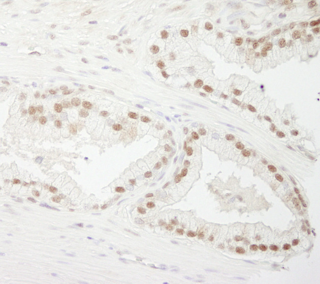 CSTF77 Antibody in Immunohistochemistry (Paraffin) (IHC (P))
