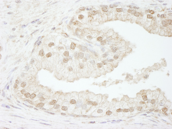 CAF-1 p60 Antibody in Immunohistochemistry (Paraffin) (IHC (P))