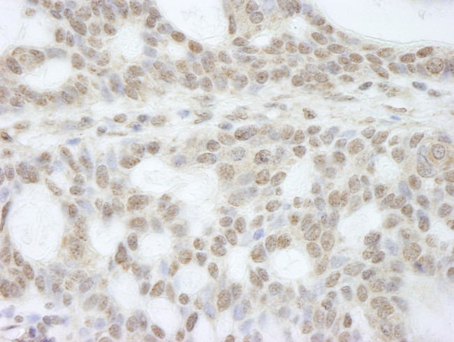 ATRX Antibody in Immunohistochemistry (Paraffin) (IHC (P))