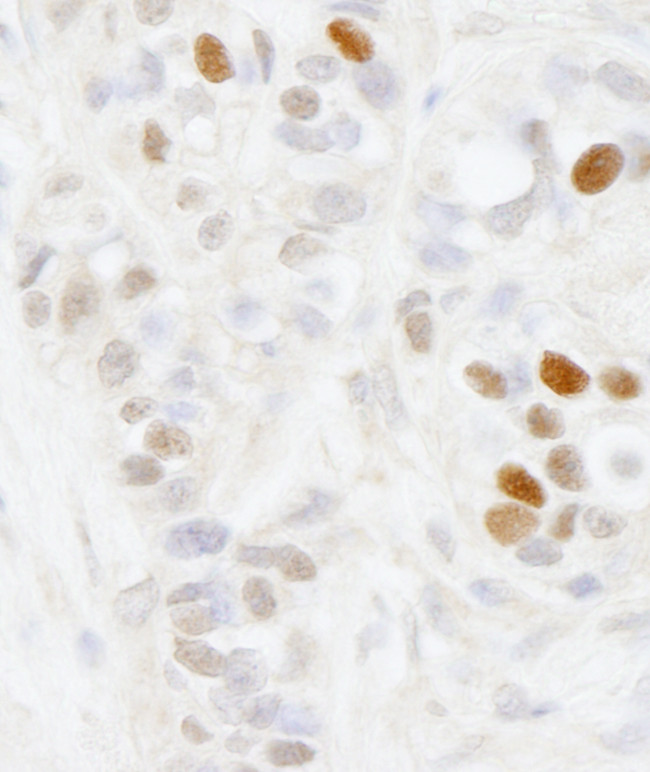 MAGED2 Antibody in Immunohistochemistry (Paraffin) (IHC (P))