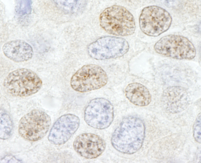 DDX46 Antibody in Immunohistochemistry (Paraffin) (IHC (P))