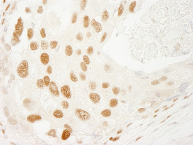 PML Antibody in Immunohistochemistry (Paraffin) (IHC (P))