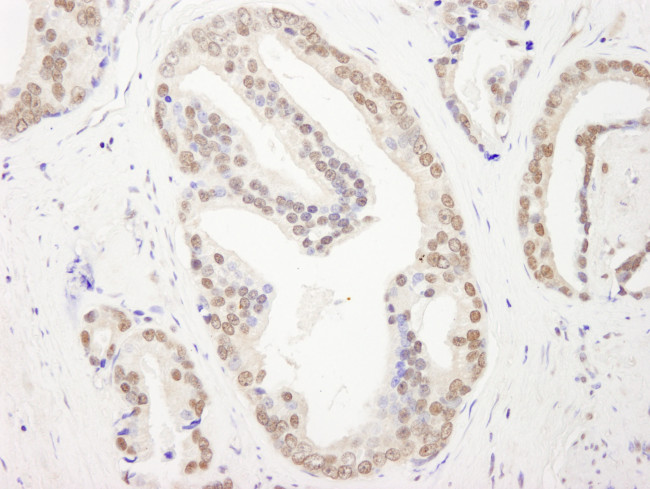 RBM26 Antibody in Immunohistochemistry (Paraffin) (IHC (P))