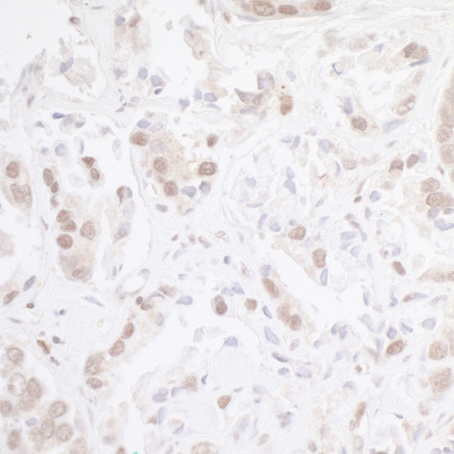 CHD8 Antibody in Immunohistochemistry (Paraffin) (IHC (P))