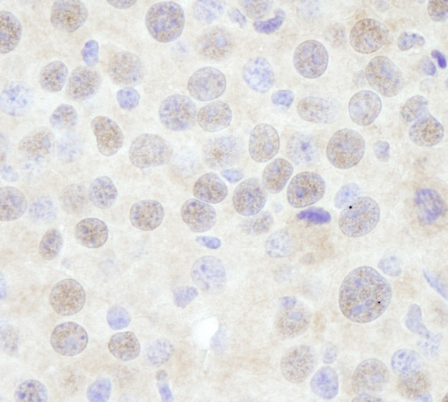 CHD3 Antibody in Immunohistochemistry (Paraffin) (IHC (P))