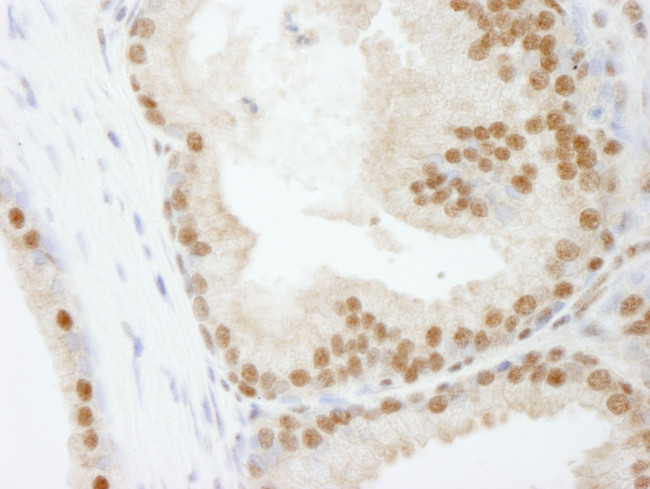 PolD3/p66 Antibody in Immunohistochemistry (Paraffin) (IHC (P))