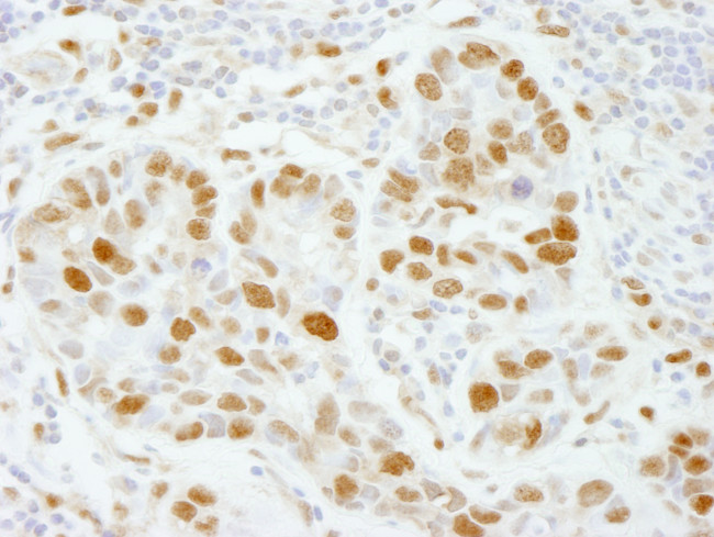 PolE3/p17 Antibody in Immunohistochemistry (Paraffin) (IHC (P))