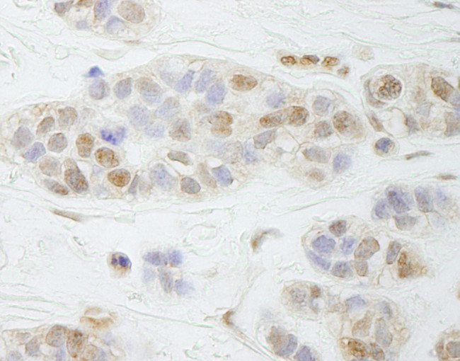 PALB2 Antibody in Immunohistochemistry (Paraffin) (IHC (P))