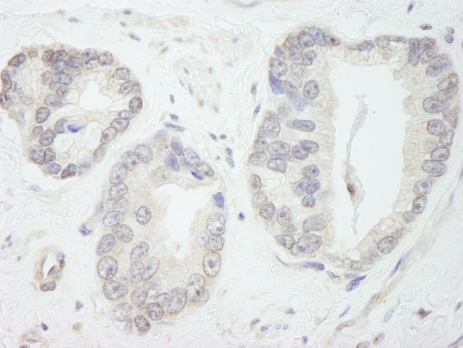 GTF3C1/TFIIIC220 Antibody in Immunohistochemistry (Paraffin) (IHC (P))