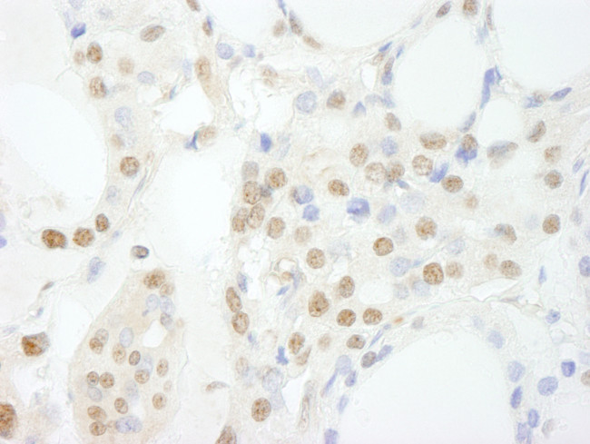 GTF3C3/TFIIIC102 Antibody in Immunohistochemistry (Paraffin) (IHC (P))