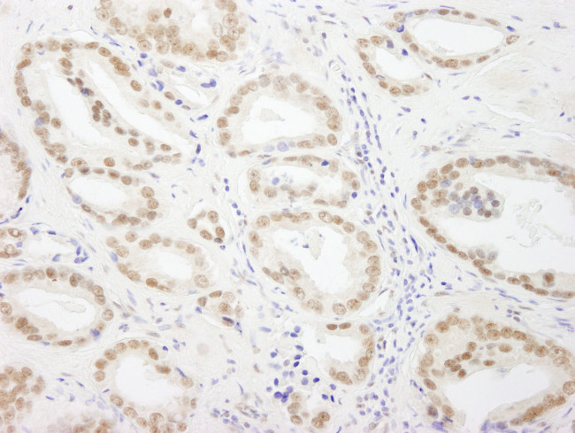 GTF3C5/TFIIIC63 Antibody in Immunohistochemistry (Paraffin) (IHC (P))