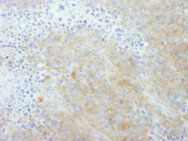 PTPN12 Antibody in Immunohistochemistry (Paraffin) (IHC (P))