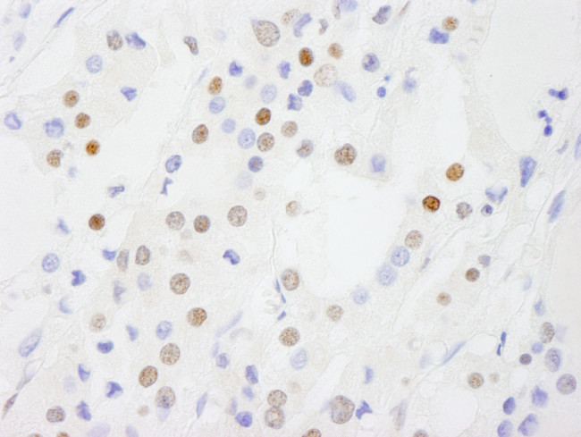 DDX54 Antibody in Immunohistochemistry (Paraffin) (IHC (P))
