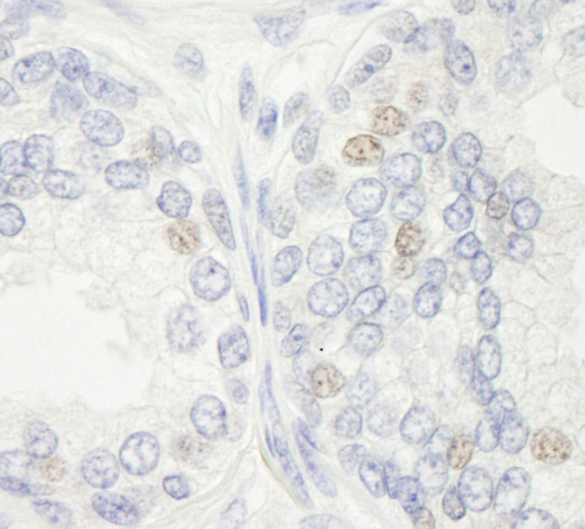 XPF/ERCC4 Antibody in Immunohistochemistry (Paraffin) (IHC (P))