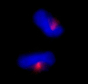 CEP170 Antibody in Immunocytochemistry (ICC/IF)