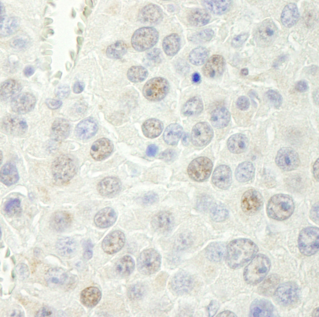 Rtf1 Antibody in Immunohistochemistry (Paraffin) (IHC (P))