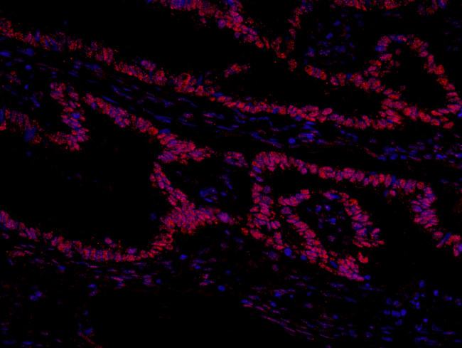 GTF2I/TFII-I Antibody in Immunohistochemistry (Paraffin) (IHC (P))
