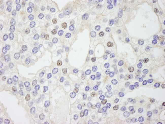 GTF2IRD/TFII-IRD1 Antibody in Immunohistochemistry (Paraffin) (IHC (P))