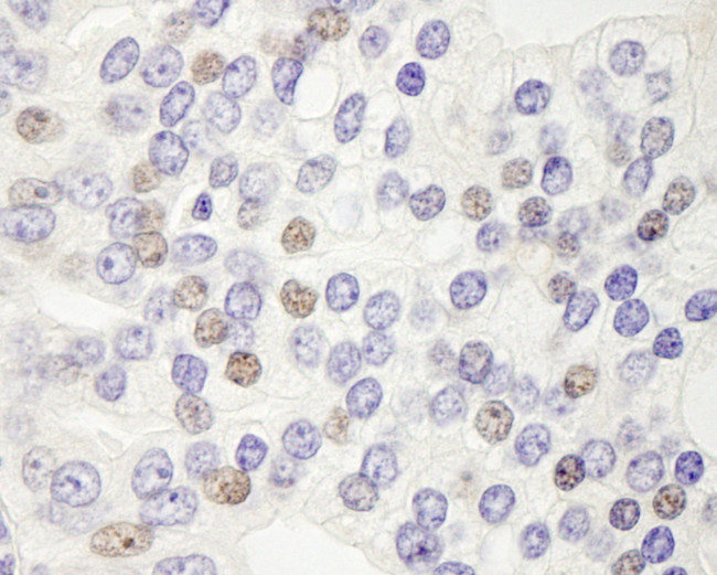DEK Antibody in Immunohistochemistry (Paraffin) (IHC (P))