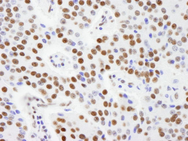 AKAP8L/HA95 Antibody in Immunohistochemistry (Paraffin) (IHC (P))