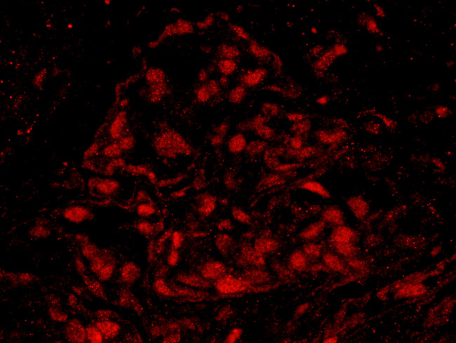 BRCA1 Antibody in Immunohistochemistry (Paraffin) (IHC (P))