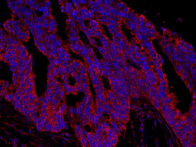 AKAP1 Antibody in Immunohistochemistry (Paraffin) (IHC (P))