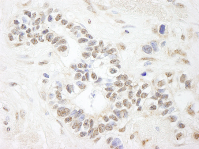 ANKS3 Antibody in Immunohistochemistry (Paraffin) (IHC (P))