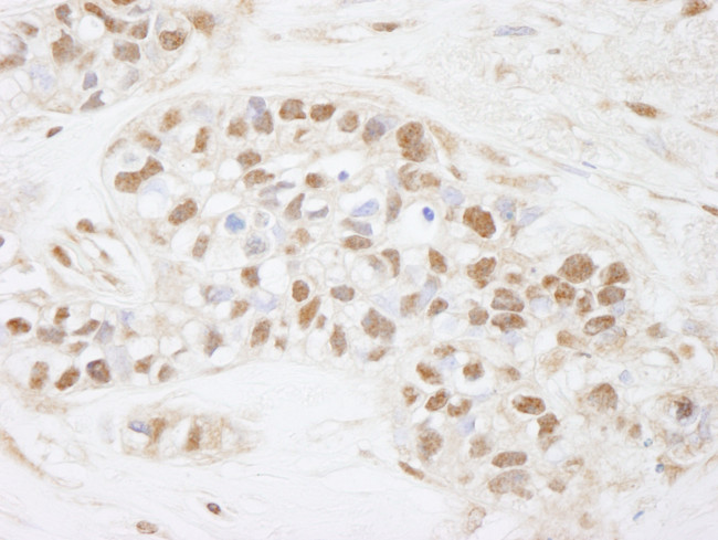CDC25c Antibody in Immunohistochemistry (Paraffin) (IHC (P))
