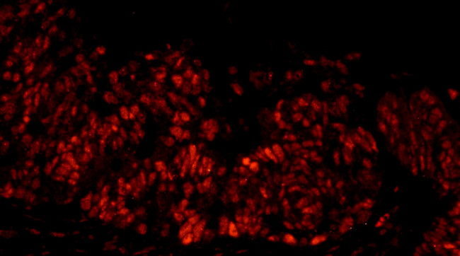 DFF45/DFFA Antibody in Immunohistochemistry (Paraffin) (IHC (P))