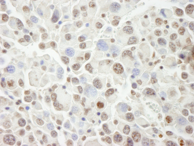 PHF6 Antibody in Immunohistochemistry (Paraffin) (IHC (P))