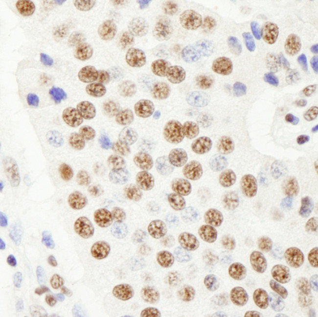 FIP1 Antibody in Immunohistochemistry (Paraffin) (IHC (P))