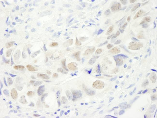 Anillin Antibody in Immunohistochemistry (Paraffin) (IHC (P))