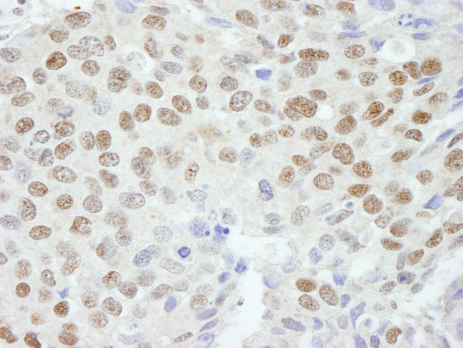 ZNF295 Antibody in Immunohistochemistry (Paraffin) (IHC (P))