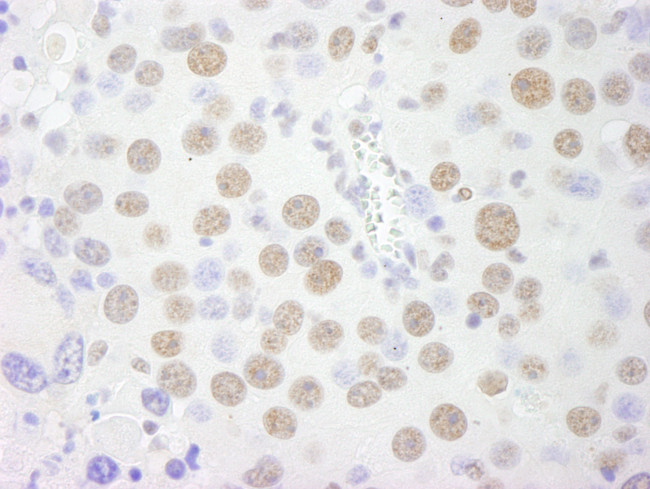 PSF/SFPQ Antibody in Immunohistochemistry (Paraffin) (IHC (P))