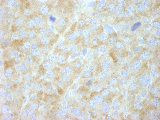 FASN Antibody in Immunohistochemistry (Paraffin) (IHC (P))