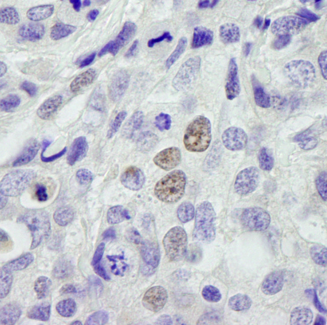 INT11 Antibody in Immunohistochemistry (Paraffin) (IHC (P))
