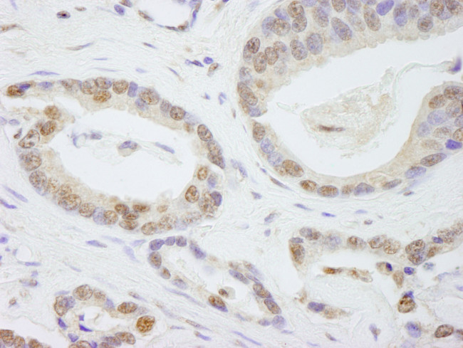 TAF6 Antibody in Immunohistochemistry (Paraffin) (IHC (P))