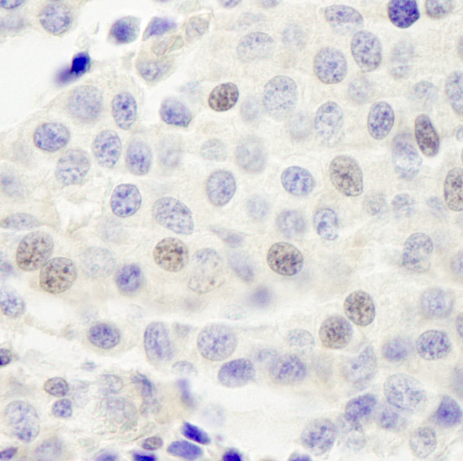 INT4 Antibody in Immunohistochemistry (Paraffin) (IHC (P))
