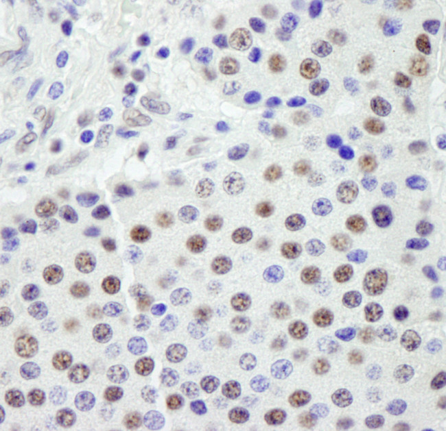 SF3a120/SAP114 Antibody in Immunohistochemistry (Paraffin) (IHC (P))