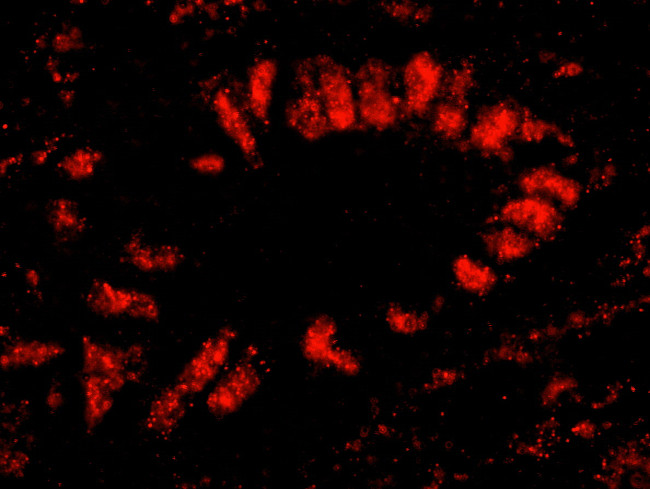 SF3b145/SAP145 Antibody in Immunohistochemistry (Paraffin) (IHC (P))