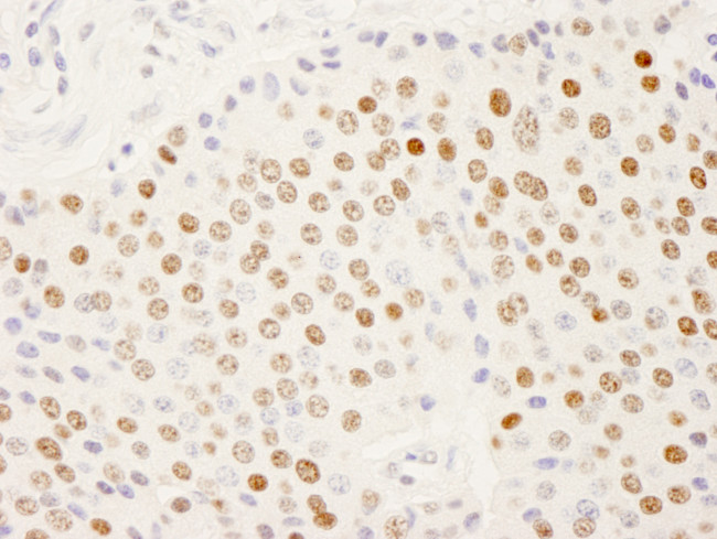 SFRS14 Antibody in Immunohistochemistry (Paraffin) (IHC (P))
