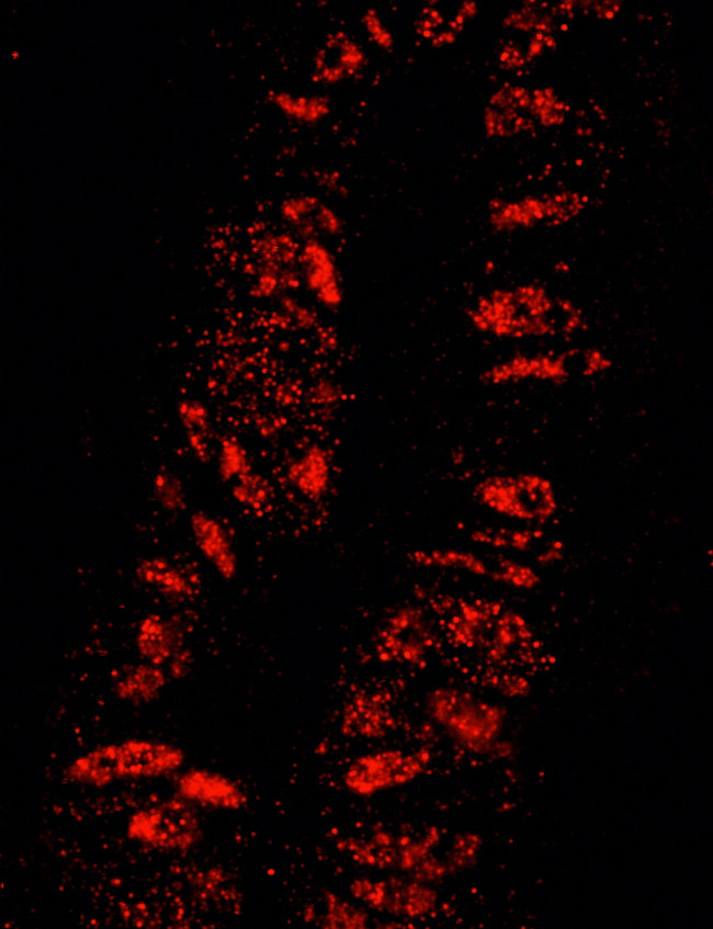 KPNA3 Antibody in Immunohistochemistry (Paraffin) (IHC (P))