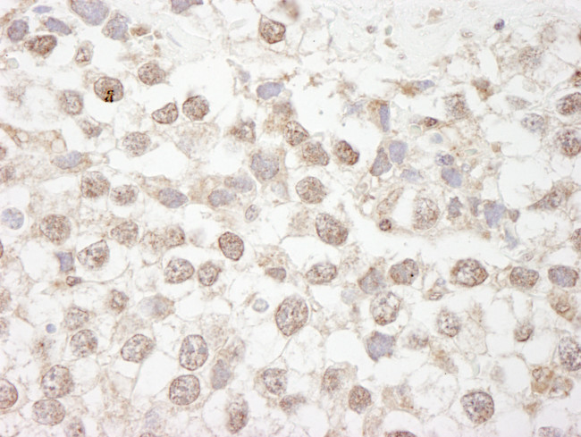 MBD4 Antibody in Immunohistochemistry (Paraffin) (IHC (P))