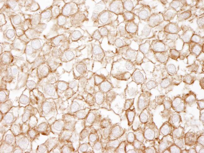 eEF2 Antibody in Immunohistochemistry (Paraffin) (IHC (P))
